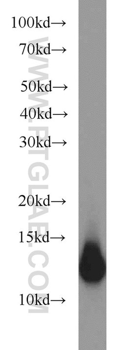 S100A11 Rabbit anti-Human, Mouse, Rat, Polyclonal, Proteintech 150 &mu;L;