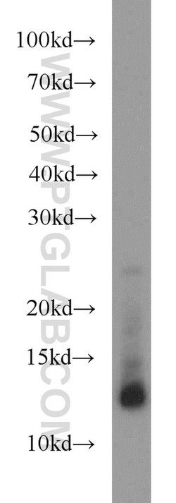 S100A11 Rabbit anti-Human, Mouse, Rat, Polyclonal, Proteintech 150 &mu;L;