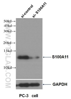 S100A11 Rabbit anti-Human, Mouse, Rat, Polyclonal, Proteintech 150 &mu;L;