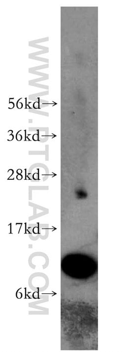 S100A11 Rabbit anti-Human, Mouse, Rat, Polyclonal, Proteintech 150 &mu;L;
