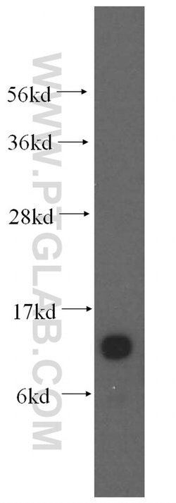 S100A11 Rabbit anti-Human, Mouse, Rat, Polyclonal, Proteintech 150 &mu;L;