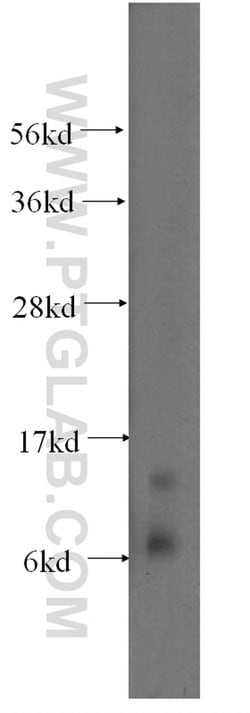 S100A11 Rabbit anti-Human, Mouse, Rat, Polyclonal, Proteintech 150 &mu;L;