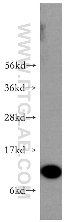 S100A11 Rabbit anti-Human, Mouse, Rat, Polyclonal, Proteintech 150 &mu;L;