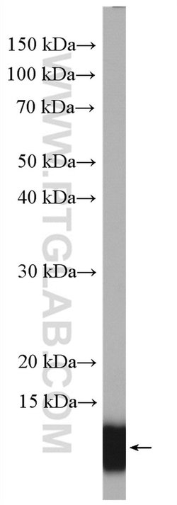 S100A11 Rabbit anti-Human, Mouse, Rat, Polyclonal, Proteintech 150 &mu;L;