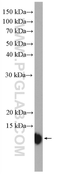 S100A11 Rabbit anti-Human, Mouse, Rat, Polyclonal, Proteintech 150 &mu;L;
