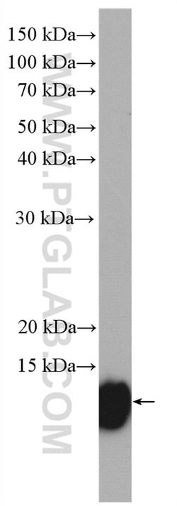 S100A11 Rabbit anti-Human, Mouse, Rat, Polyclonal, Proteintech 150 &mu;L;
