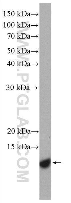 S100A11 Rabbit anti-Human, Mouse, Rat, Polyclonal, Proteintech 150 &mu;L;