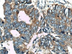 USP11 Rabbit anti-Human, Polyclonal, Proteintech 150 &mu;L; Unconjugated:Antibodies,