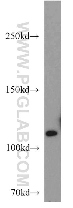 USP11 Rabbit anti-Human, Polyclonal, Proteintech 150 &mu;L; Unconjugated:Antibodies,