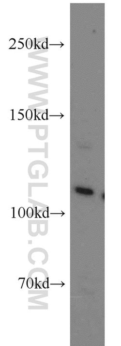 USP11 Rabbit anti-Human, Polyclonal, Proteintech 150 &mu;L; Unconjugated:Antibodies,