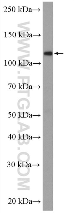 USP11 Rabbit anti-Human, Polyclonal, Proteintech 150 &mu;L; Unconjugated:Antibodies,