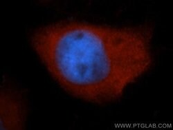 S100A6 Rabbit anti-Human, Polyclonal, Proteintech:Antibodies:Primary Antibodies