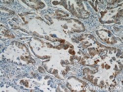S100A6 Rabbit anti-Human, Polyclonal, Proteintech:Antibodies:Primary Antibodies