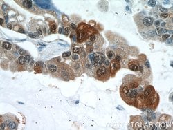 S100A6 Rabbit anti-Human, Polyclonal, Proteintech:Antibodies:Primary Antibodies