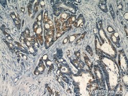 S100A6 Rabbit anti-Human, Polyclonal, Proteintech:Antibodies:Primary Antibodies