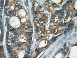S100A6 Rabbit anti-Human, Polyclonal, Proteintech:Antibodies:Primary Antibodies