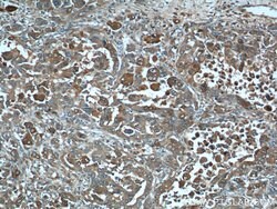 S100A6 Rabbit anti-Human, Polyclonal, Proteintech:Antibodies:Primary Antibodies