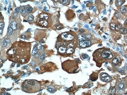 S100A6 Rabbit anti-Human, Polyclonal, Proteintech:Antibodies:Primary Antibodies