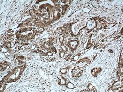 S100A6 Rabbit anti-Human, Polyclonal, Proteintech:Antibodies:Primary Antibodies