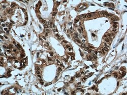 S100A6 Rabbit anti-Human, Polyclonal, Proteintech:Antibodies:Primary Antibodies