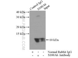 S100A6 Rabbit anti-Human, Polyclonal, Proteintech:Antibodies:Primary Antibodies