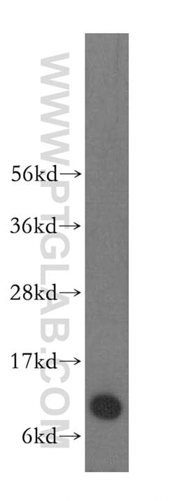 S100A6 Rabbit anti-Human, Polyclonal, Proteintech:Antibodies:Primary Antibodies