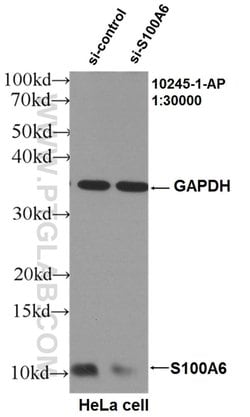 S100A6 Rabbit anti-Human, Polyclonal, Proteintech:Antibodies:Primary Antibodies