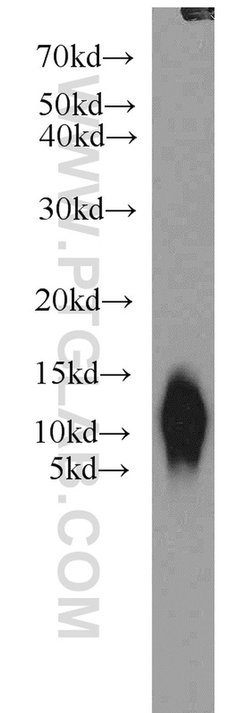 S100A6 Rabbit anti-Human, Polyclonal, Proteintech:Antibodies:Primary Antibodies