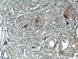 CD82 Rabbit anti-Human, Mouse, Polyclonal, Proteintech 20 &mu;L; Unconjugated:Antibodies,