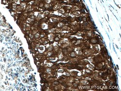 GDI1 Rabbit anti-Human, Mouse, Rat, Polyclonal, Proteintech:Antibodies:Primary