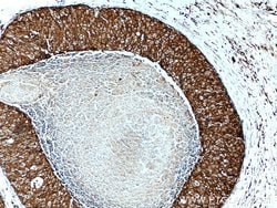 GDI1 Rabbit anti-Human, Mouse, Rat, Polyclonal, Proteintech:Antibodies:Primary