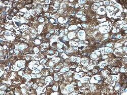 GDI1 Rabbit anti-Human, Mouse, Rat, Polyclonal, Proteintech:Antibodies:Primary