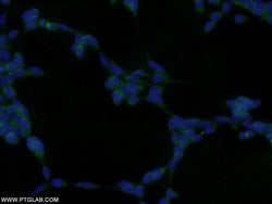 GRB2 Rabbit anti-Human, Mouse, Rat, Polyclonal, Proteintech:Antibodies:Primary