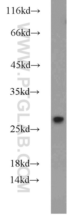GRB2 Rabbit anti-Human, Mouse, Rat, Polyclonal, Proteintech:Antibodies:Primary
