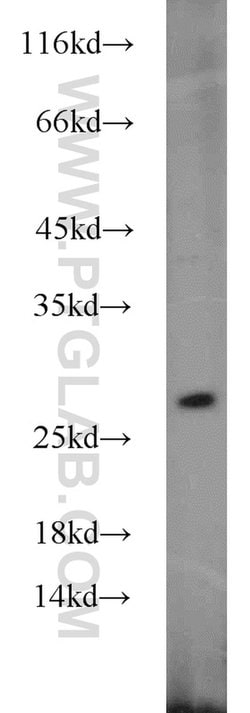 GRB2 Rabbit anti-Human, Mouse, Rat, Polyclonal, Proteintech:Antibodies:Primary