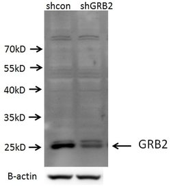 GRB2 Rabbit anti-Human, Mouse, Rat, Polyclonal, Proteintech:Antibodies:Primary