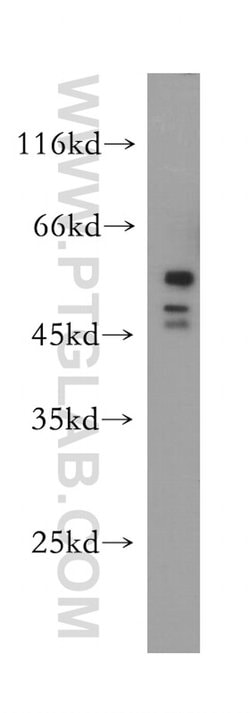 HDAC3 Rabbit anti-Human, Mouse, Rat, Polyclonal, Proteintech:Antibodies:Primary