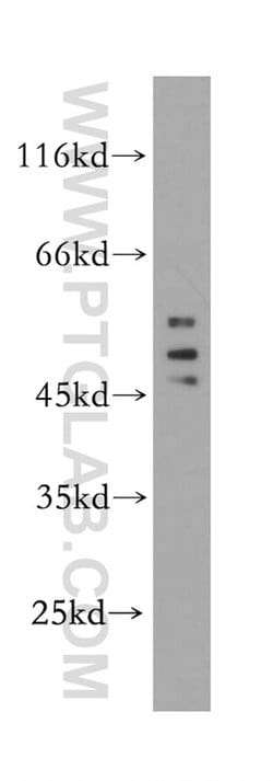 HDAC3 Rabbit anti-Human, Mouse, Rat, Polyclonal, Proteintech:Antibodies:Primary