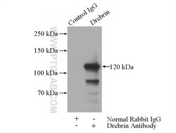 Drebrin Rabbit anti-Human, Mouse, Rat, Polyclonal, Proteintech 150 &mu;L | Buy Online | Proteintech Group Inc | Fisher Scientific