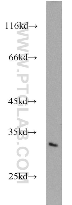 MEA1 Rabbit anti-Human, Mouse, Rat, Polyclonal, Proteintech 20 &mu;L; Unconjugated:Antibodies,