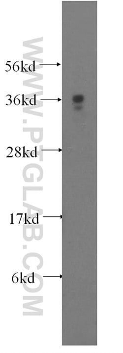 MEA1 Rabbit anti-Human, Mouse, Rat, Polyclonal, Proteintech 20 &mu;L; Unconjugated:Antibodies,