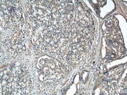 IkB alpha Rabbit anti-Human, Mouse, Porcine, Polyclonal, Proteintech 150
