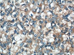 IkB alpha Rabbit anti-Human, Mouse, Porcine, Polyclonal, Proteintech 150