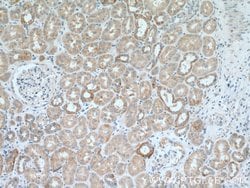 IkB alpha Rabbit anti-Human, Mouse, Porcine, Polyclonal, Proteintech 150