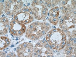 Proteintech IkB alpha Rabbit anti-Human, Mouse, Porcine, Polyclonal, Proteintech
