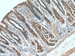 IkB alpha Rabbit anti-Human, Mouse, Porcine, Polyclonal, Proteintech 150