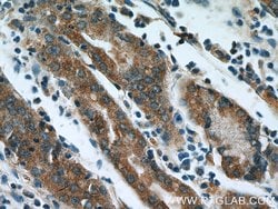 IkB alpha Rabbit anti-Human, Mouse, Porcine, Polyclonal, Proteintech 150