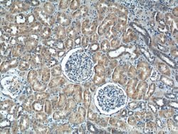 IkB alpha Rabbit anti-Human, Mouse, Porcine, Polyclonal, Proteintech 150