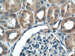 IkB alpha Rabbit anti-Human, Mouse, Porcine, Polyclonal, Proteintech 150