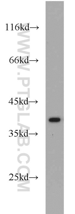 IkB alpha Rabbit anti-Human, Mouse, Porcine, Polyclonal, Proteintech 150